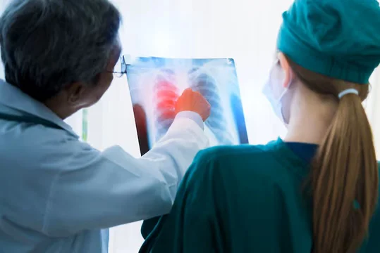 fibrosis pulmonar