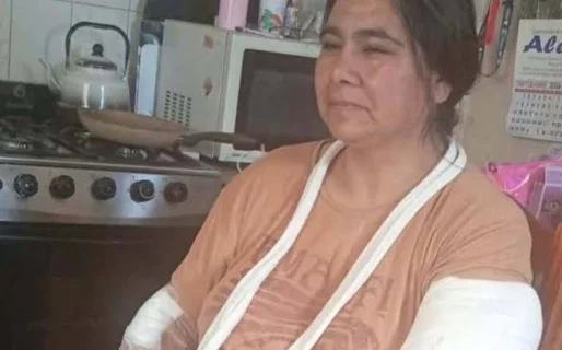 Mujer mordida por dogo Trelew