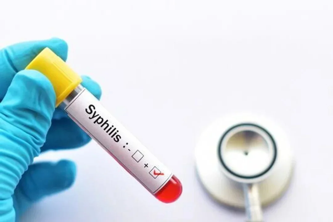 Sifilis